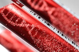 Guardant Health (GH) Receives FDA Approval for Guardant360 CDx Diagnostic to Enhance Colorectal Cancer Treatment